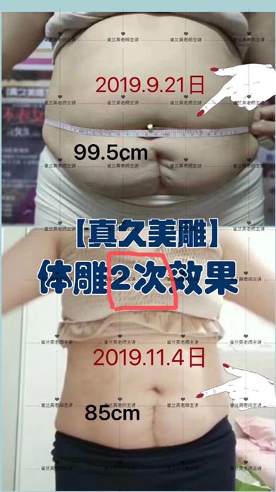 Belly Size Reduction